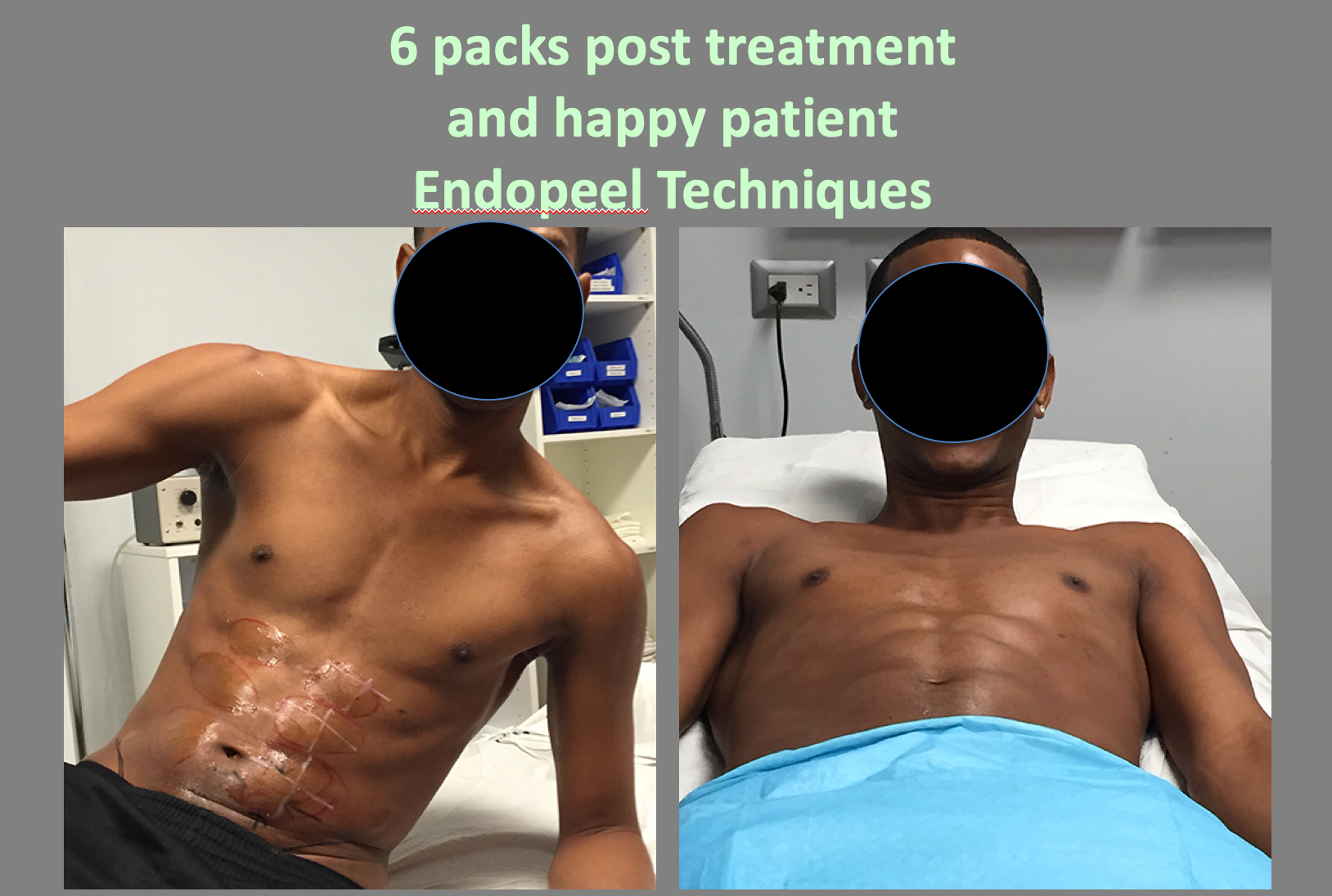 happy 6 packs male patient