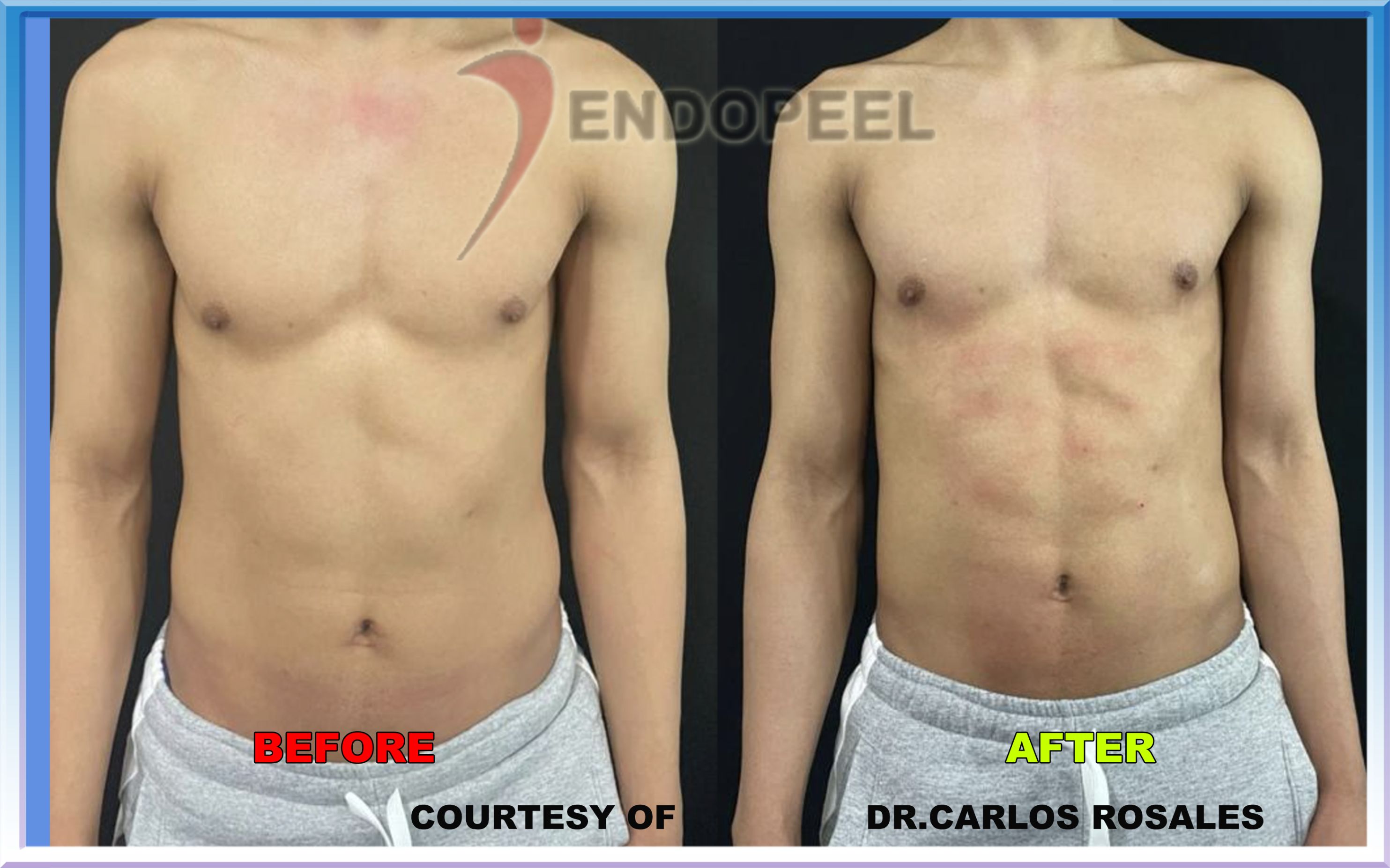 millenium-6packs-frontal-view-carlos